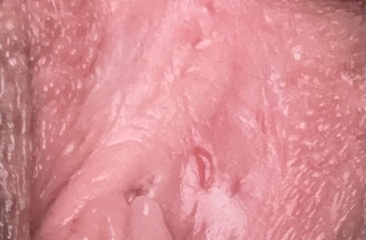 Problem with down below *[content warning: contains pics]