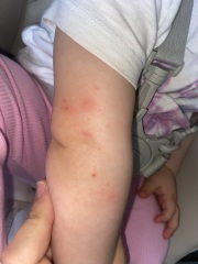 Anyone know what these spots could be??