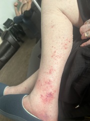 Any drs/nurses can help identify this pls?
