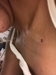 Moles