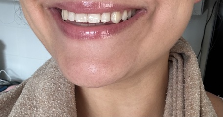 What could be done with my lips? Pics
