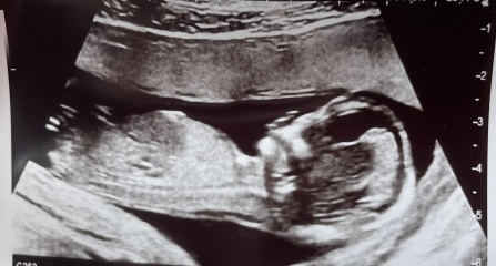 Girl or Boy predictions?