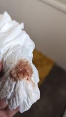 Help is this implantation bleeding