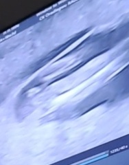 Potty shot clarity?