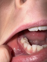 Any dentists? What is this? Photo