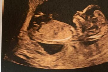 Boy or girl? 13 weeks ultrasound