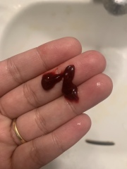 Blood clot or worse?