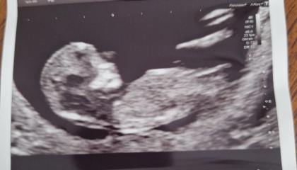 Gender guess?