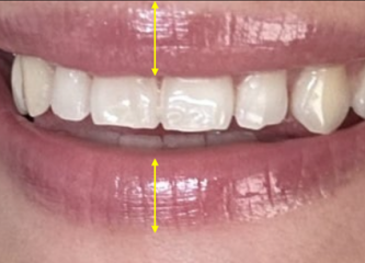 What could be done with my lips? Pics