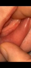 Teething baby