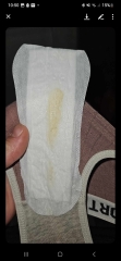 Help! Yellow discharge looking.