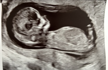 Any guesses for the gender please🩷💙