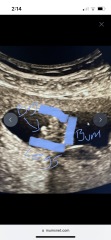 Help with potty shot 14 weeks