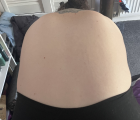 Bad posture or something more?