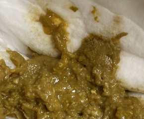 Mucus in poo? **pics possibly TMI**