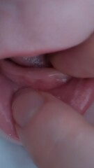 Teething for a Lifetime!