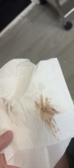 Miscarriage