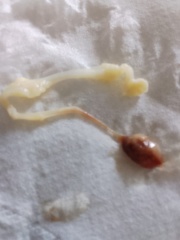 What is this that i passed in bath