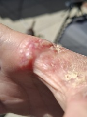 How long till antibiotics kick in?