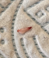 Thought it was a tick but ohhhh