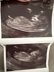 Gender guesses