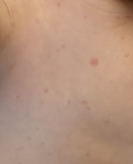 Worried my 1yo has meningitis