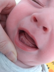 When will these teeth cut through?!