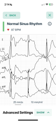 ECG help - is this weird?