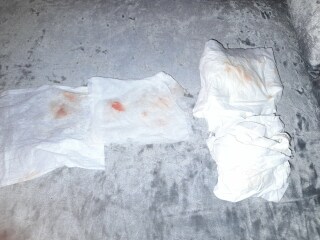 Is this implantation bleeding