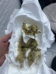 Help. Baby so cross despite changing t milk. Warning nappy photos attached!