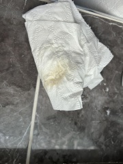 High hcg no yolk sac