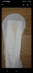 Help! Yellow discharge looking.