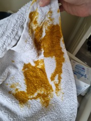 Is this normal? (Tw poo pic)
