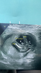 Due February 2025 - Thread 3