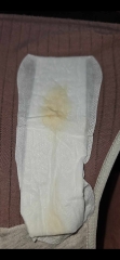 Help! Yellow discharge looking.