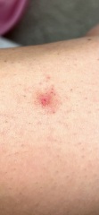 Weird spot on leg