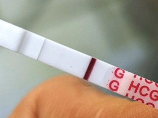 Sorry to be that guy but... is there a shadow of a line here?!