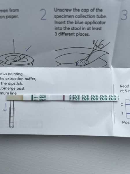 Fecal occult test - is this positive?
