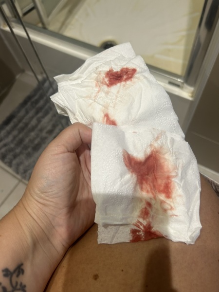 Random bleed / brown smudge...what's  happening