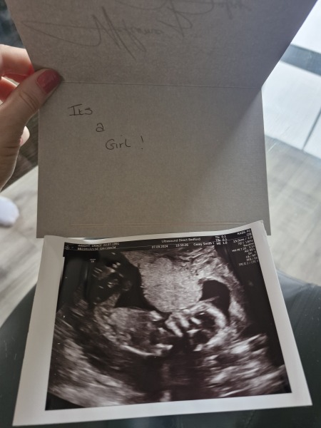 BFP after IVF - the journey continues (part 2)