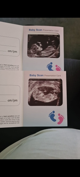 Miracle IVF Cyprus by Dr. Firdevs