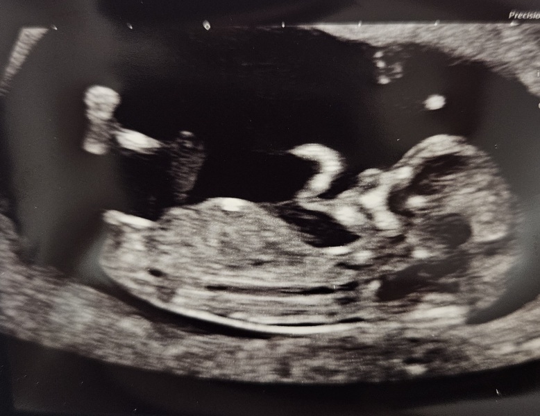 Gender guesses