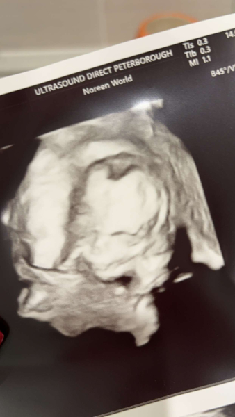 Due March 2025 thread 2