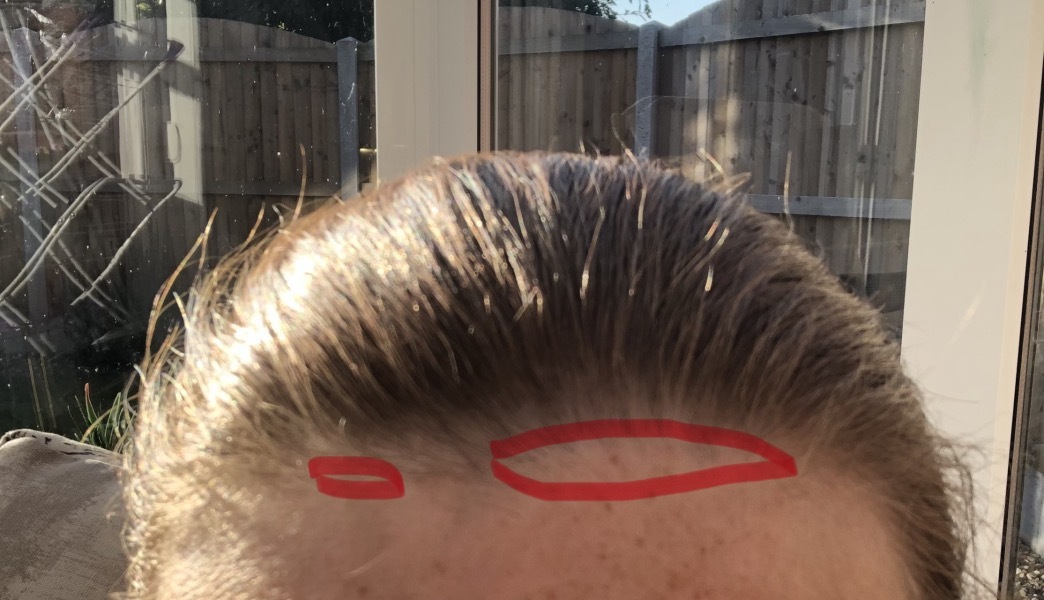 To cut the front piece of my hair off? With pics