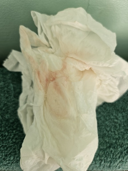 Is this implantation bleed or period - PIC ATTACHED