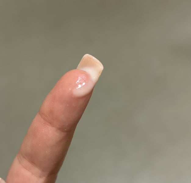 Early pregnancy discharge or pre period? TTC