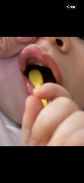 Top tooth split
