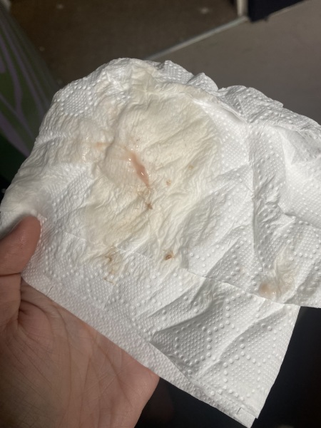 Pink discharge, 3rd pregnancy after 2 miscarriages