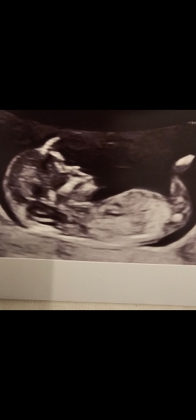 Can anyone guess the gender for me please?