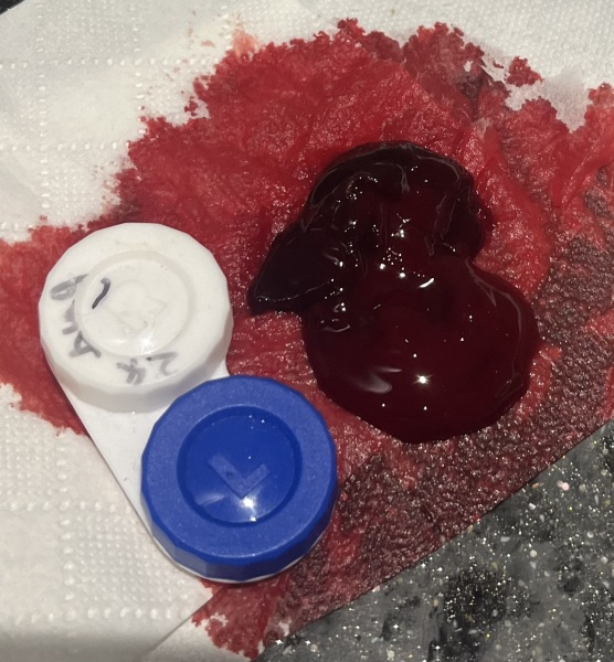 Hope no are your period clots? Pic warning!